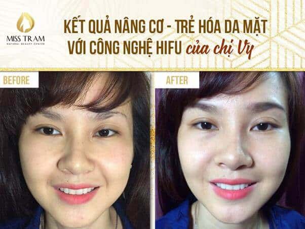 - Top 4 Most Effective Skin Rejuvenation Beauty Salons in Binh Thanh District