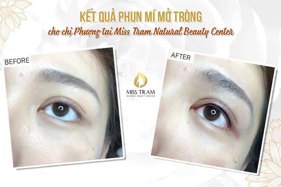 - Top 5 Most Beautiful Eyelid Spray Addresses in Binh Thanh Area