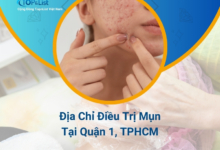 Địa Chỉ Điều Trị Mụn Quận 1, TPHCM Uy Tín