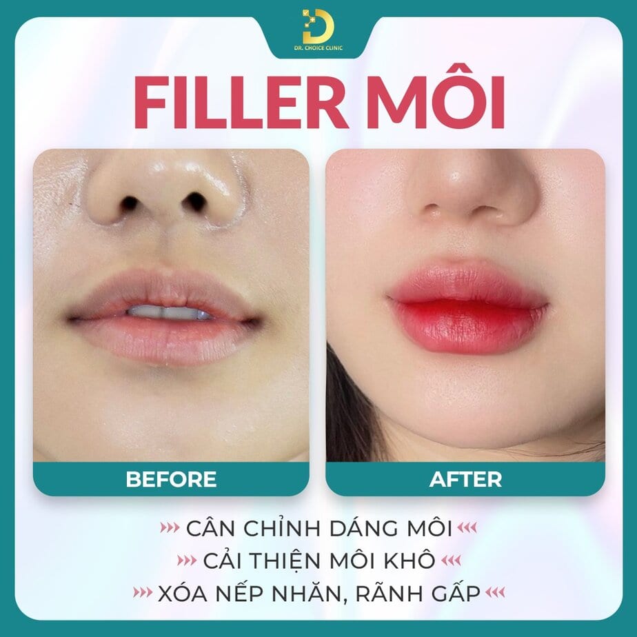 Nguồn ảnh: Fanpage Dr. Choice Clinic