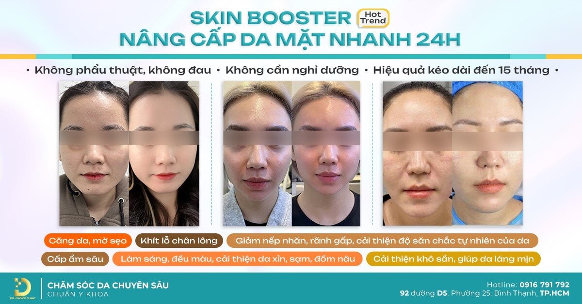 - Top 4 Thẩm Mỹ Viện Trẻ Hóa Da Hiệu Quả Nhất Quận Bình Thạnh
