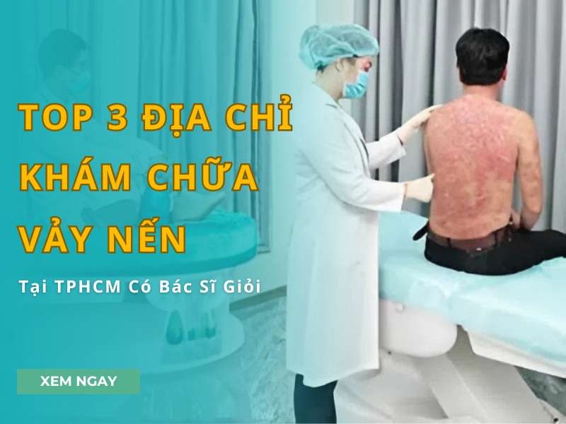 Top 3 địa chỉ khám chữa vảy nến tại TPHCM - Top 3 Địa Chỉ Khám Chữa Vảy Nến Tại TPHCM Có Bác Sĩ Giỏi Top 3 địa chỉ khám chữa vảy nến tại TPHCM