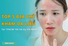Top 5 địa chỉ khám da liễu tại TPHCM