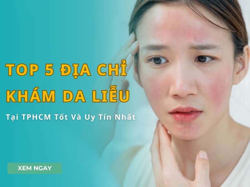 Top 5 địa chỉ khám da liễu tại TPHCM - Top 5 Địa Chỉ Khám Da Liễu Tại TPHCM Tốt Và Uy Tín Nhất Top 5 địa chỉ khám da liễu tại TPHCM