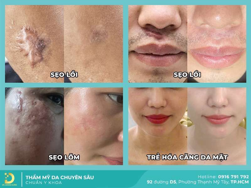 Điều trị, chăm sóc da tại Dr. Choice Clinic - Top 5 Địa Chỉ Khám Da Liễu Tại TPHCM Tốt Và Uy Tín Nhất Điều trị, chăm sóc da tại Dr. Choice Clinic