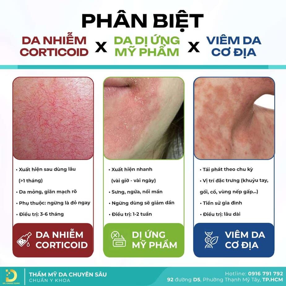 Dr. Choice Clinic chuyên điều trị viêm da cơ địa / chàm tại HCM - Top 3 Địa Chỉ Khám Viêm Da Cơ Địa Ở TPHCM Uy Tín, Bác Sĩ Giỏi Điều Trị Dr. Choice Clinic chuyên điều trị viêm da cơ địa / chàm tại HCM
