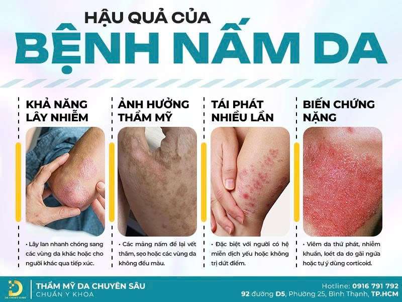 Dr. Choice Clinic chuyên điều trị nấm da lâu năm - 5 Địa Chỉ Khám Chữa Bệnh Nấm Da ở TPHCM Uy Tín, Bác Sĩ Giỏi Dr. Choice Clinic chuyên điều trị nấm da lâu năm