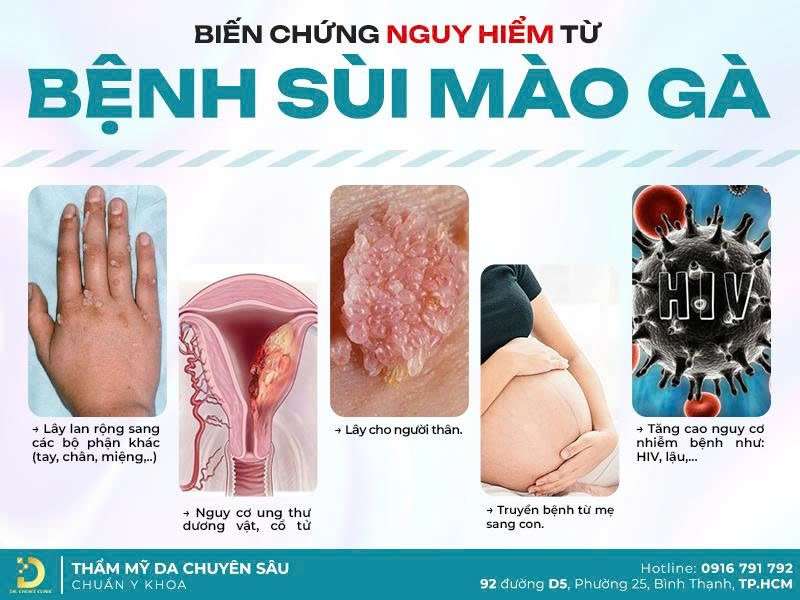 Dr. Choice Clinic chuyên điều trị sùi mào gà khó trị - 3 Địa Chỉ Khám Chữa Sùi Mào Gà Tại TPHCM Uy Tín Hàng Đầu Dr. Choice Clinic chuyên điều trị sùi mào gà khó trị